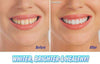 LED Ultrasonic Dental Tooth Pic - Dream Morocco